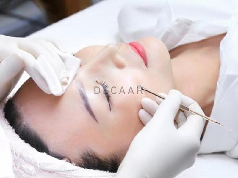 Điều trị mụn đúng cách